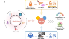 阿里达摩院推出MAOSS模型 AI筛查脂肪肝效率倍增